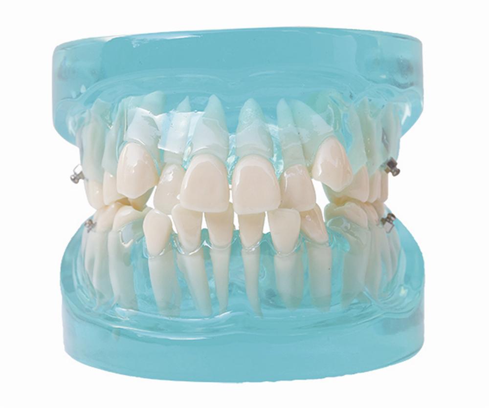 HST-B2 Orthodontic Model