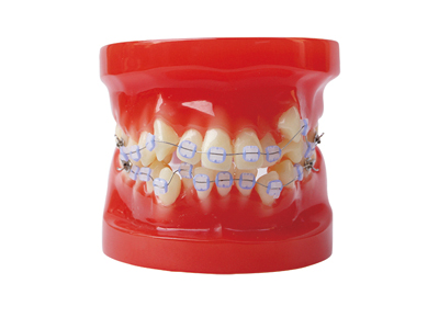 HST-B4-03 Ortho Ceramic Bracket Model