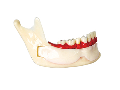 HST-N14下頜骨組織分解模型