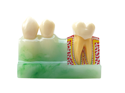 HST-M4  4Times Sized Tooth Disassembling Model