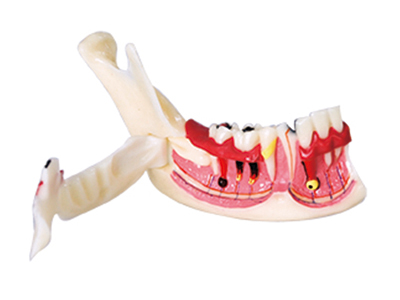 HST-N14 Organization of Mandible