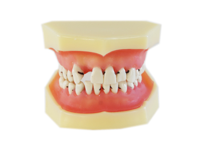 HST-L4 Peridontal Disease Model